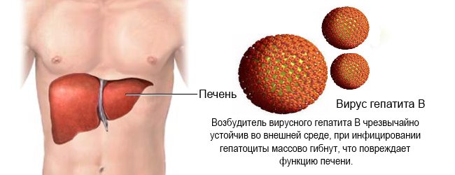 Гепатит б развитие. Вирусный гепатит печень. Печень при вирусном гепатите.